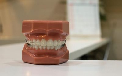5 cosas que debes saber sobre la ortodoncia