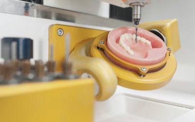 ¿Conoces la tecnología CAD-CAM de nuestra clínica dental de Móstoles?