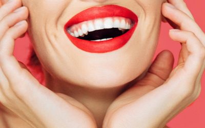 5 beneficios del blanqueamiento dental