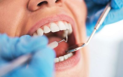 ¿Qué es un curetaje dental?