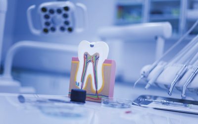 ¿Cuál es la diferencia entre endodoncia y empaste?