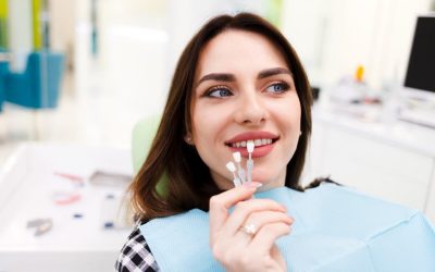 ¿Se pueden quitar o sustituir las carillas dentales?
