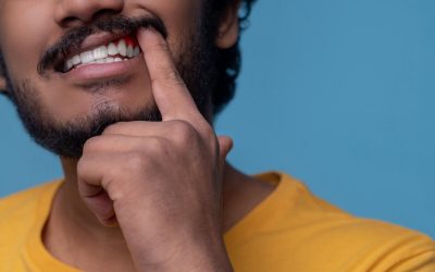 ¿La piorrea es contagiosa?