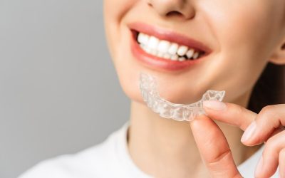 La ortodoncia invisible y sus beneficios