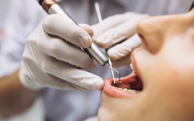 Las 8 cirugías bucales más frecuentes