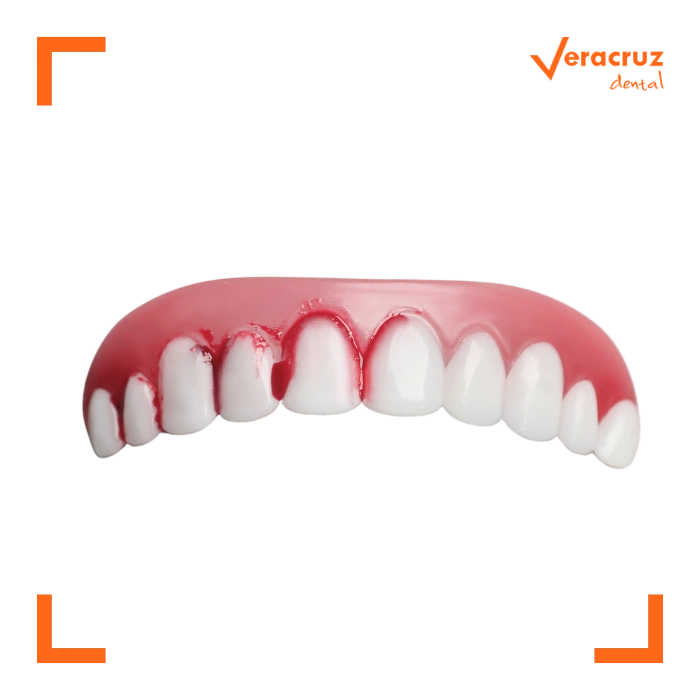 servicio de periodoncia en mostoles